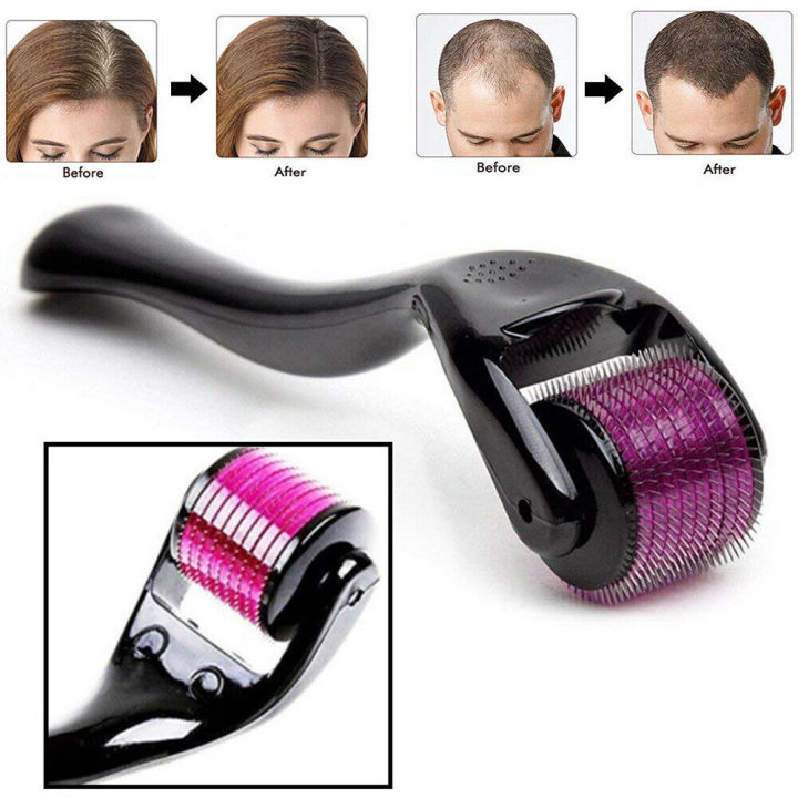Derma Roller 0.5mm – for Hair & Skin Rejuvenation
