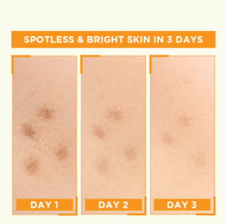 Garnier Skin Active Bright Complete Vitamin C Booster Serum (15ml)! ✨