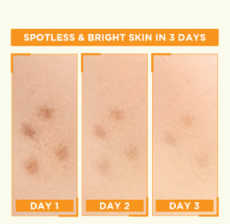 Garnier Skin Active Bright Complete Vitamin C Booster Serum 30 ML - Contains Niacinamide